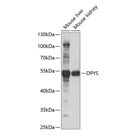 Western Blot - Anti-DPYS Antibody (A15190) - Antibodies.com