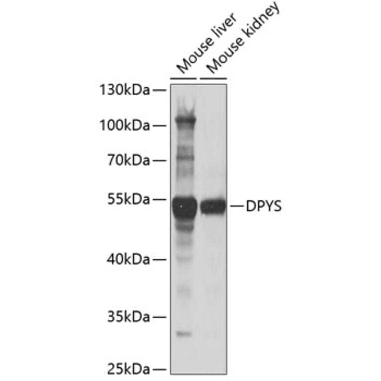 Western Blot - Anti-DPYS Antibody (A15190) - Antibodies.com