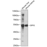 Western Blot - Anti-DPYS Antibody (A15190) - Antibodies.com