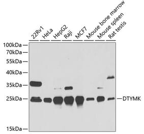 Western Blot - Anti-DTYMK Antibody (A15191) - Antibodies.com