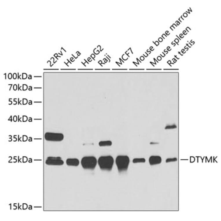 Western Blot - Anti-DTYMK Antibody (A15191) - Antibodies.com