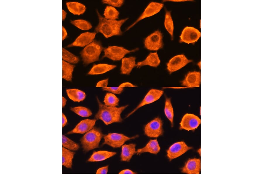 Immunofluorescence - Anti-DTYMK Antibody (A15191) - Antibodies.com