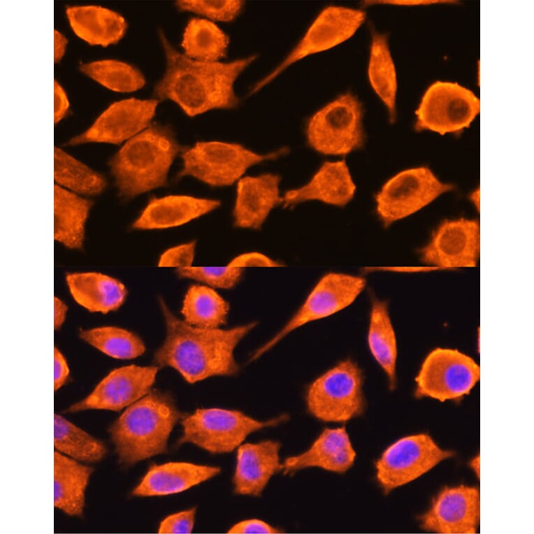 Immunofluorescence - Anti-DTYMK Antibody (A15191) - Antibodies.com