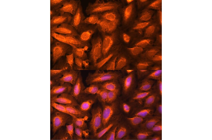 Immunofluorescence - Anti-DTYMK Antibody (A15191) - Antibodies.com