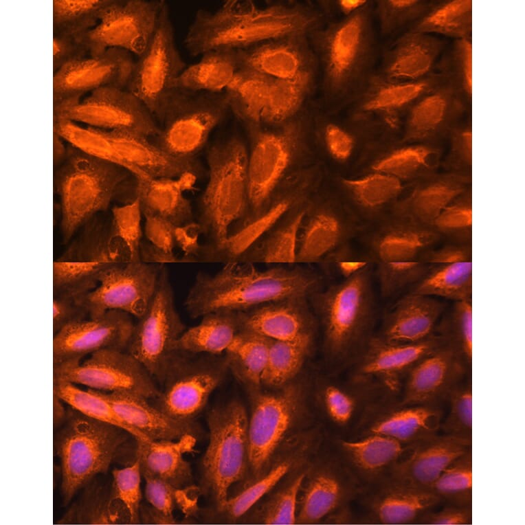 Immunofluorescence - Anti-DTYMK Antibody (A15191) - Antibodies.com