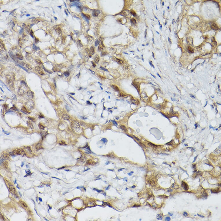Immunohistochemistry - Anti-ESE1 Antibody (A15192) - Antibodies.com