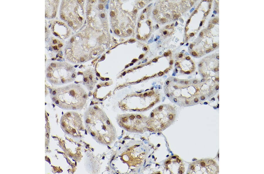 Immunohistochemistry - Anti-ESE1 Antibody (A15192) - Antibodies.com
