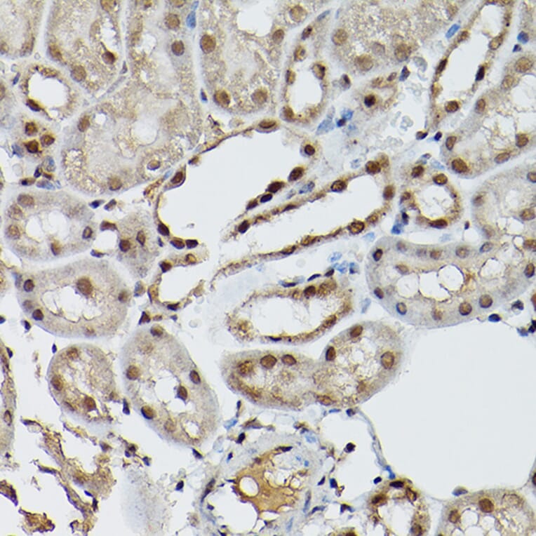 Immunohistochemistry - Anti-ESE1 Antibody (A15192) - Antibodies.com