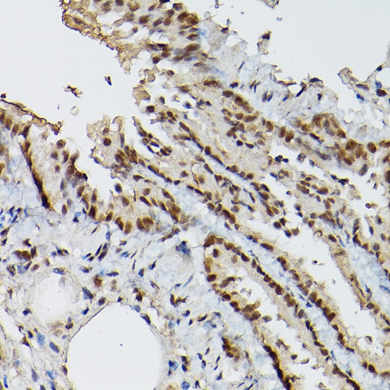 Immunohistochemistry - Anti-ESE1 Antibody (A15192) - Antibodies.com