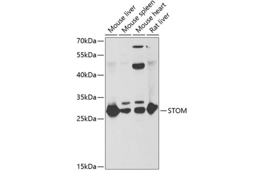 Western Blot - Anti-Stomatin Antibody (A15193) - Antibodies.com