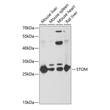 Western Blot - Anti-Stomatin Antibody (A15193) - Antibodies.com