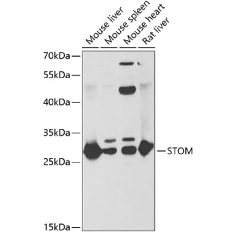 Western Blot - Anti-Stomatin Antibody (A15193) - Antibodies.com