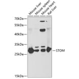 Western Blot - Anti-Stomatin Antibody (A15193) - Antibodies.com