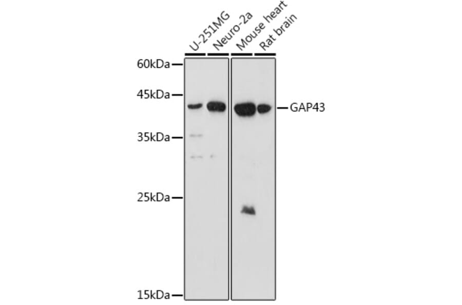 Western Blot - Anti-GAP43 Antibody (A15195) - Antibodies.com