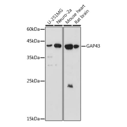 Western Blot - Anti-GAP43 Antibody (A15195) - Antibodies.com