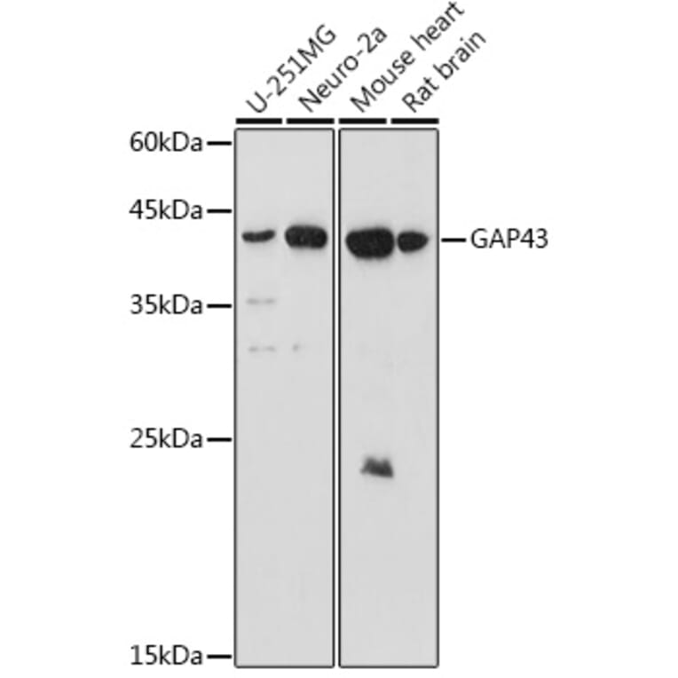 Western Blot - Anti-GAP43 Antibody (A15195) - Antibodies.com