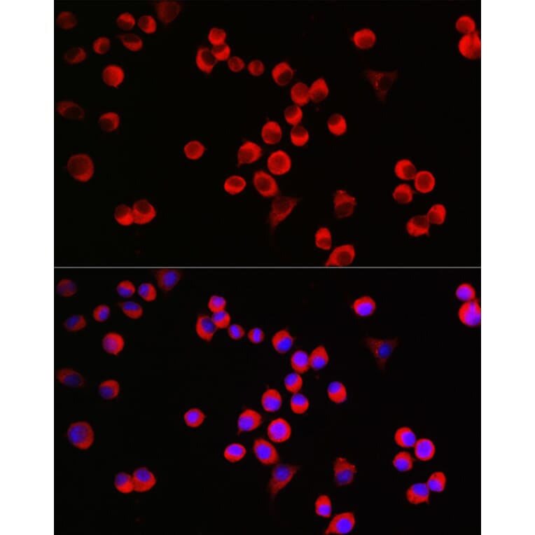Immunofluorescence - Anti-GAP43 Antibody (A15195) - Antibodies.com