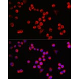 Immunofluorescence - Anti-GAP43 Antibody (A15195) - Antibodies.com