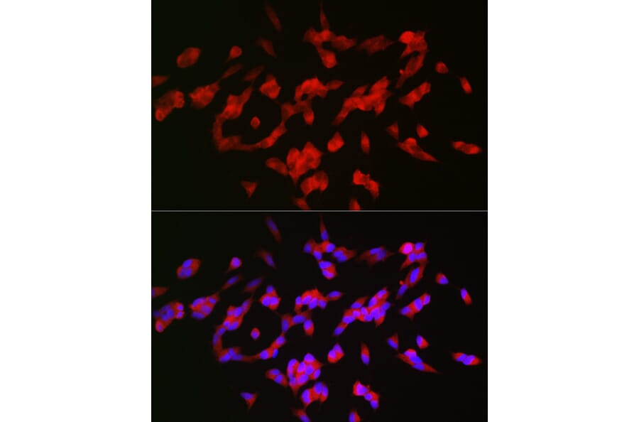 Immunofluorescence - Anti-GAP43 Antibody (A15195) - Antibodies.com