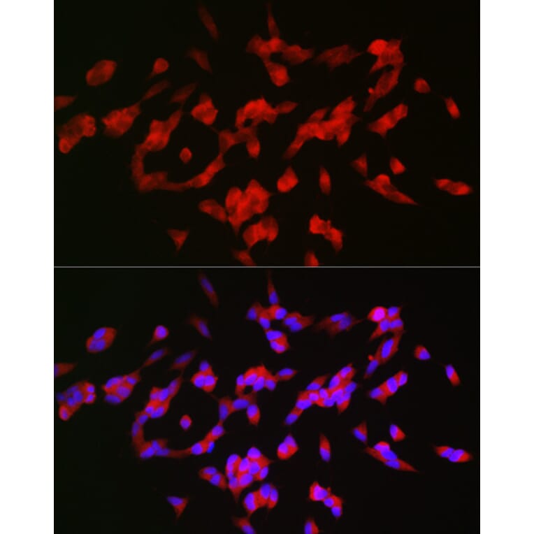 Immunofluorescence - Anti-GAP43 Antibody (A15195) - Antibodies.com