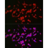 Immunofluorescence - Anti-GAP43 Antibody (A15195) - Antibodies.com