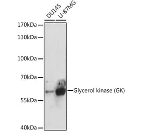 Western Blot - Anti-Glycerol kinase Antibody (A15196) - Antibodies.com