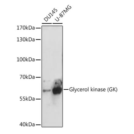 Western Blot - Anti-Glycerol kinase Antibody (A15196) - Antibodies.com