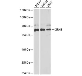 Western Blot - Anti-GRK6 Antibody (A15197) - Antibodies.com