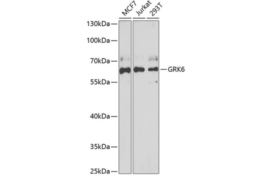 Western Blot - Anti-GRK6 Antibody (A15197) - Antibodies.com