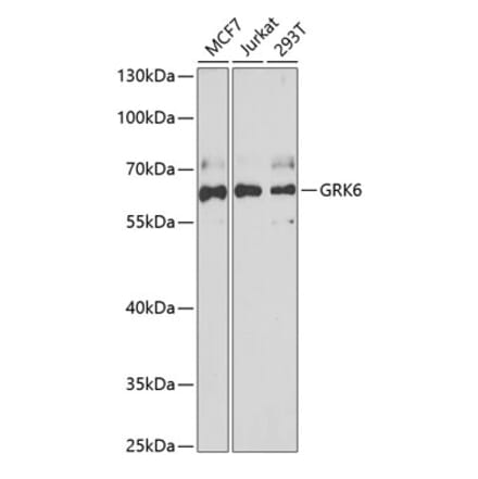 Western Blot - Anti-GRK6 Antibody (A15197) - Antibodies.com