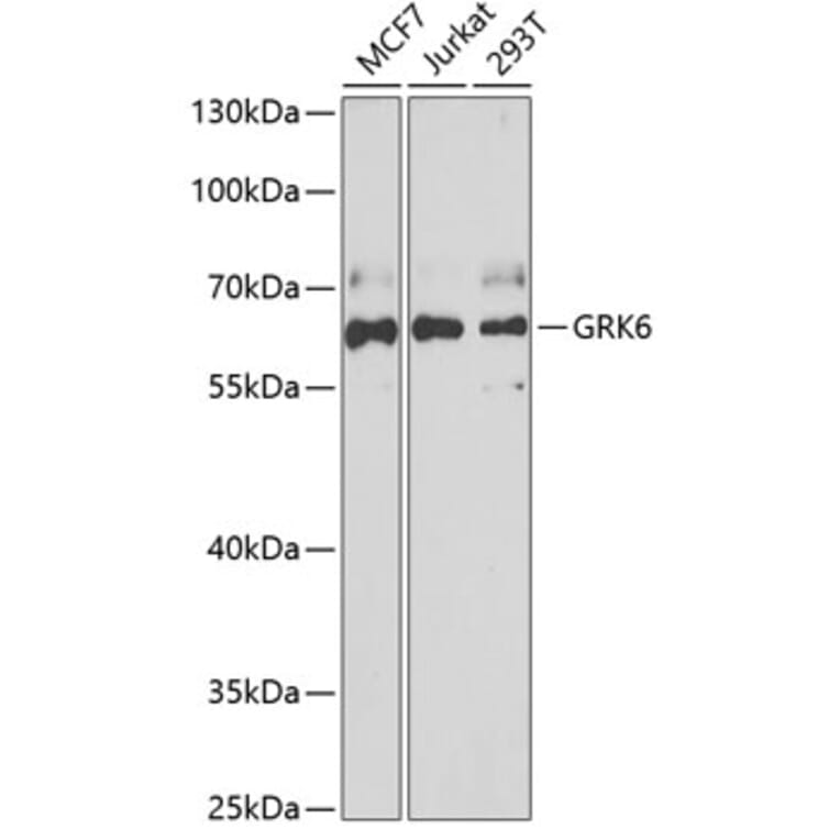 Western Blot - Anti-GRK6 Antibody (A15197) - Antibodies.com