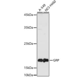 Western Blot - Anti-Gastrin Releasing Peptide Antibody (A15198) - Antibodies.com