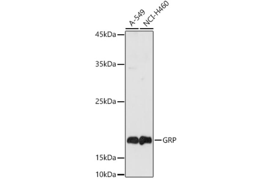 Western Blot - Anti-Gastrin Releasing Peptide Antibody (A15198) - Antibodies.com