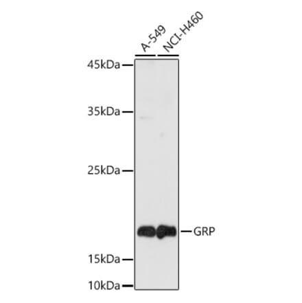 Western Blot - Anti-Gastrin Releasing Peptide Antibody (A15198) - Antibodies.com