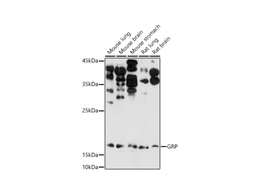 Western Blot - Anti-Gastrin Releasing Peptide Antibody (A15198) - Antibodies.com