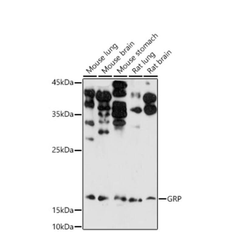 Western Blot - Anti-Gastrin Releasing Peptide Antibody (A15198) - Antibodies.com