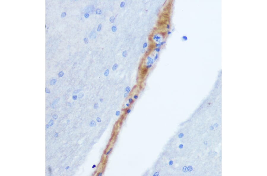 Immunohistochemistry - Anti-Gastrin Releasing Peptide Antibody (A15198) - Antibodies.com