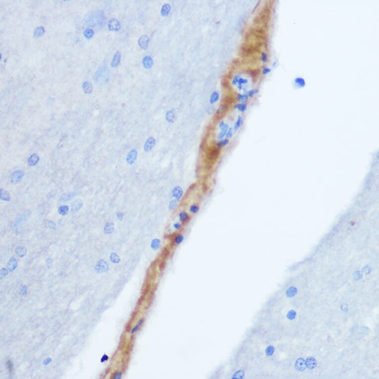 Immunohistochemistry - Anti-Gastrin Releasing Peptide Antibody (A15198) - Antibodies.com