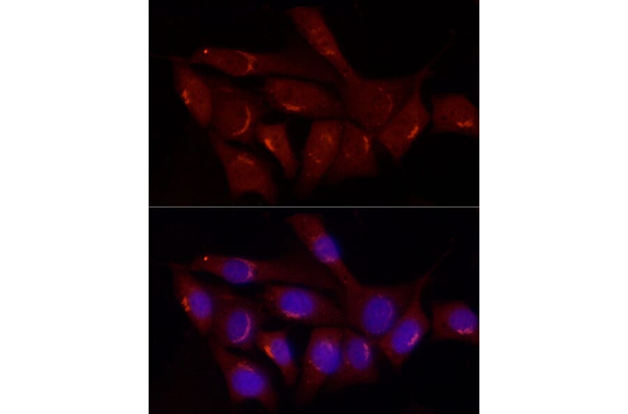 Immunofluorescence - Anti-Gastrin Releasing Peptide Antibody (A15198) - Antibodies.com