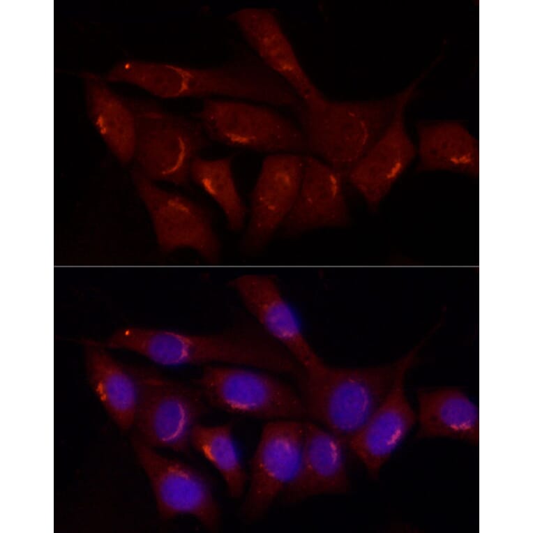 Immunofluorescence - Anti-Gastrin Releasing Peptide Antibody (A15198) - Antibodies.com