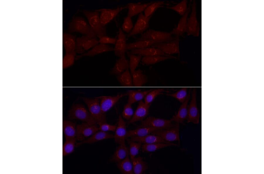 Immunofluorescence - Anti-Gastrin Releasing Peptide Antibody (A15198) - Antibodies.com