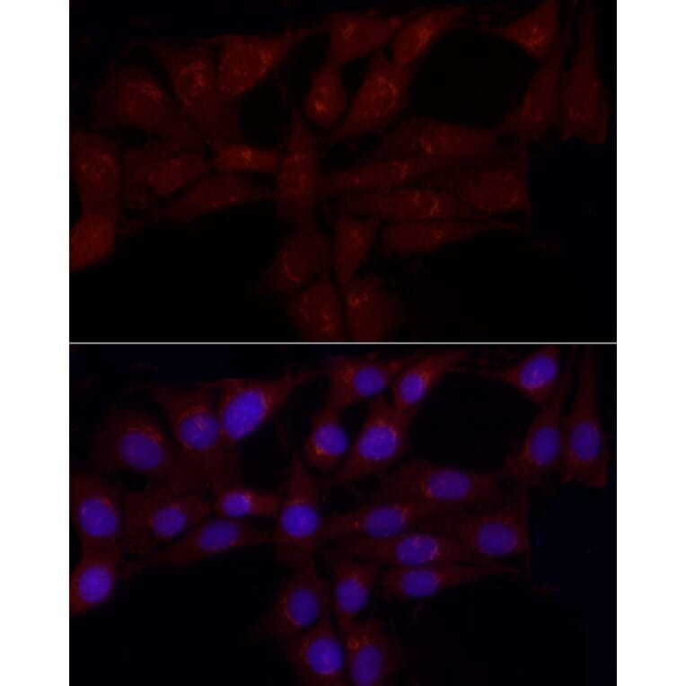Immunofluorescence - Anti-Gastrin Releasing Peptide Antibody (A15198) - Antibodies.com