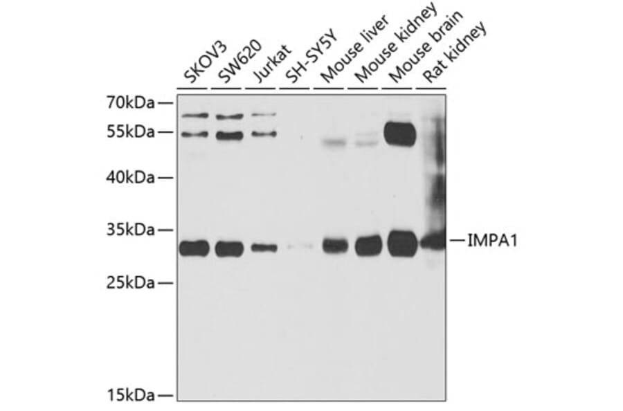 Western Blot - Anti-IMPA1 Antibody (A15199) - Antibodies.com