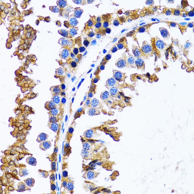 Immunohistochemistry - Anti-IMPA1 Antibody (A15199) - Antibodies.com