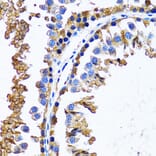 Immunohistochemistry - Anti-IMPA1 Antibody (A15199) - Antibodies.com