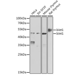Western Blot - Anti-Islet 1 Antibody (A15200) - Antibodies.com