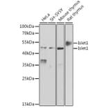 Western Blot - Anti-Islet 1 Antibody (A15200) - Antibodies.com