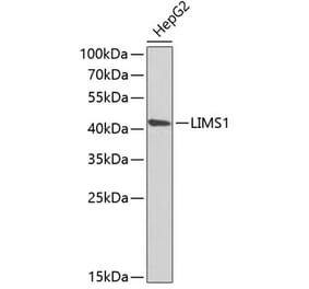 Western Blot - Anti-PINCH 1 Antibody (A15201) - Antibodies.com