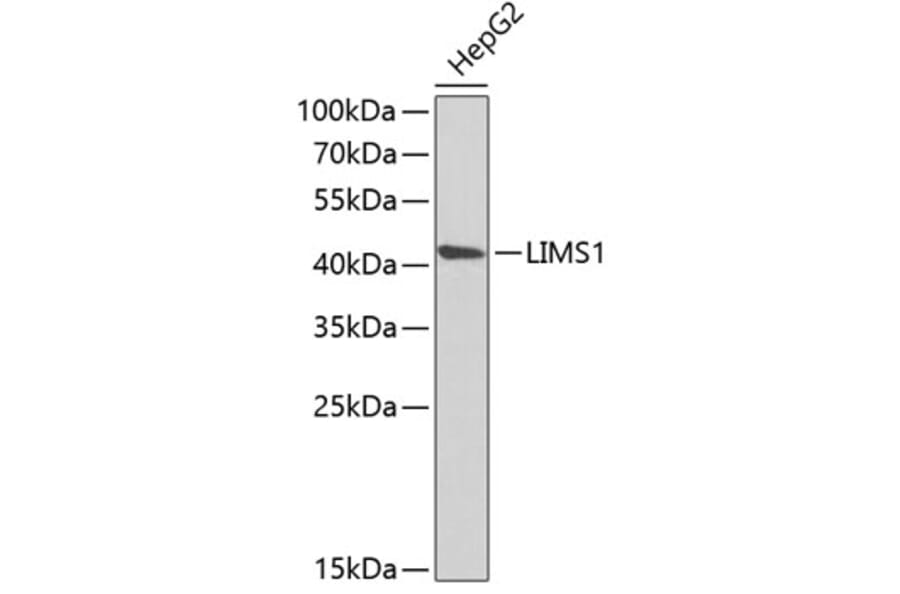 Western Blot - Anti-PINCH 1 Antibody (A15201) - Antibodies.com