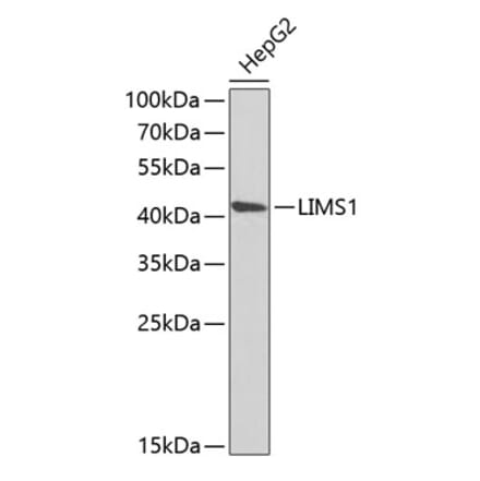 Western Blot - Anti-PINCH 1 Antibody (A15201) - Antibodies.com